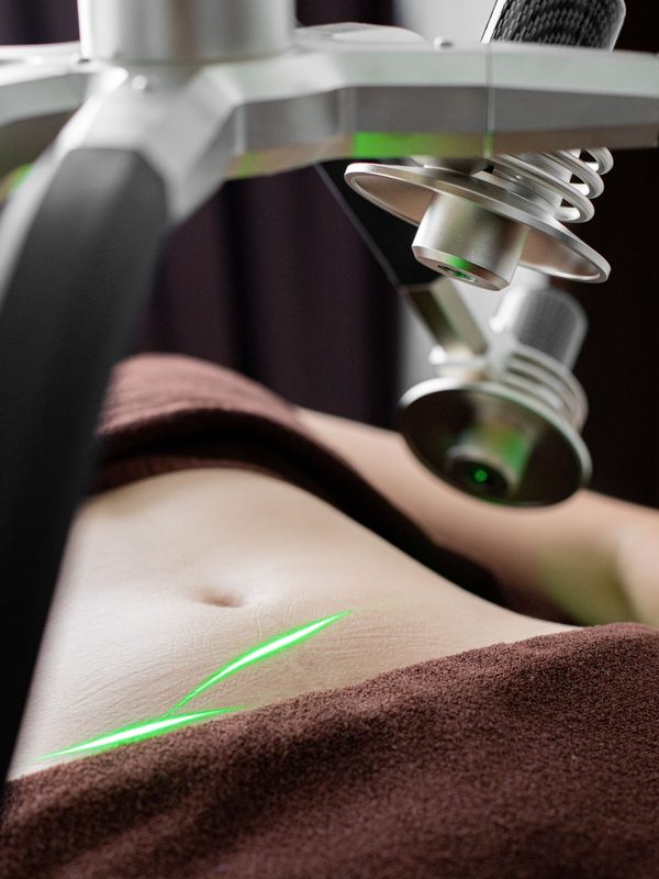 Body Contouring
